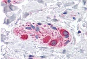 Human Colon, Submucosal Plexus: Formalin-Fixed, Paraffin-Embedded (FFPE) (BOK antibody  (C-Term))