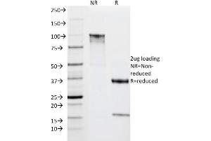 SDS-PAGE Analysis Purified HLA-DRA Mouse Monoclonal Antibody (IPO-10). (HLA-DRA antibody)