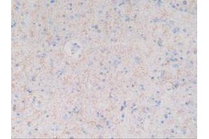 IHC-P analysis of Human Brain Tissue, with DAB staining. (MBP antibody  (AA 135-190))