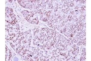 Image no. 1 for anti-Pituitary Tumor-Transforming 2 (PTTG2) (AA 2-174) antibody (ABIN1500512) (PTTG2 antibody  (AA 2-174))
