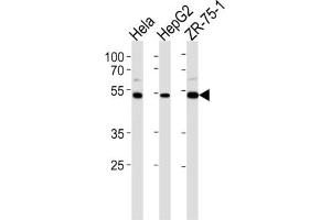 Western Blotting (WB) image for anti-Telomeric Repeat Binding Factor 2, Interacting Protein (TERF2IP) antibody (ABIN2997696) (RAP1 antibody)