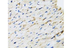 Immunohistochemistry of paraffin-embedded Rat heart using RAF1 Polyclonal Antibody at dilution of 1:100 (40x lens). (RAF1 antibody)