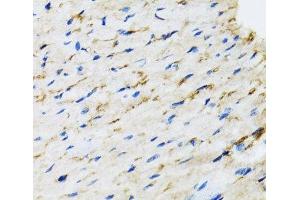 Immunohistochemistry of paraffin-embedded Rat heart using RAF1 Polyclonal Antibody at dilution of 1:100 (40x lens). (RAF1 antibody)