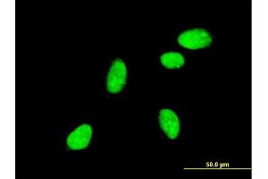 Immunofluorescence of monoclonal antibody to NEUROG2 on HeLa cell. (Neurogenin 2 antibody  (AA 36-112))