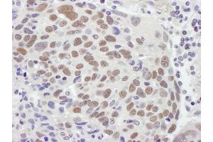 Immunohistochemistry (IHC) image for anti-Mismatch Repair Protein 2 (MSH2) (C-Term) antibody (ABIN7453440) (MSH2 antibody  (C-Term))