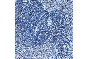 Immunohistochemistry of paraffin-embedded rat spleen using CHD3 Rabbit mAb (ABIN7266363) at dilution of 1:100 (40x lens).
