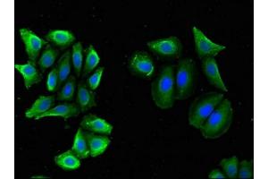 Immunofluorescent analysis of A549 cells using ABIN7145535 at dilution of 1:100 and Alexa Fluor 488-congugated AffiniPure Goat Anti-Rabbit IgG(H+L) (BACE2 antibody  (AA 84-157))