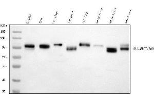 Western blot analysis of CD166/ALCAM using anti-CD166/ALCAM antibody (ABIN5518801).