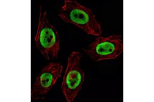 Fluorescent image of  cell stained with EZH2 Antibody (ABIN659002 and ABIN2838040) / SG100830. (EZH2 antibody)