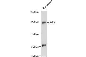 Western blot analysis of extracts of Rat kidney, using (ABIN6129376, ABIN6136636, ABIN6136637 and ABIN6221667) at 1:1000 dilution. (AGO1 antibody  (AA 1-180))