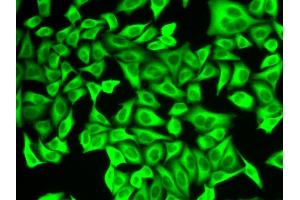 Immunofluorescence analysis of A549 cells using ALDH4A1 antibody. (ALDH4A1 antibody  (AA 354-563))