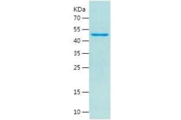 Androgen Receptor Protein (AR) (AA 650-920) (His-IF2DI Tag)