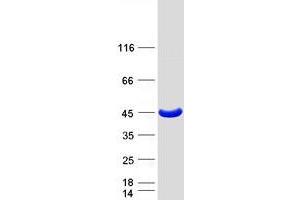Western Blotting (WB) image for phosphoribosyl Pyrophosphate Synthetase-Associated Protein 1 (PRPSAP1) protein (Myc-DYKDDDDK Tag) (ABIN2729836)