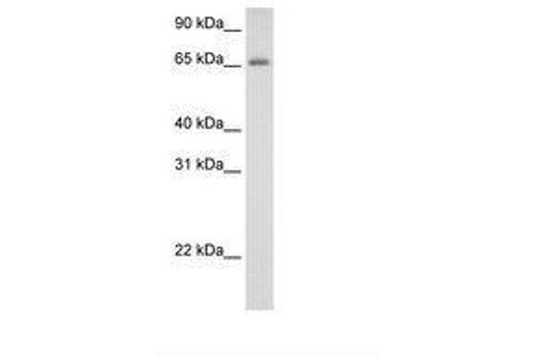 ADAT1 antibody  (C-Term)