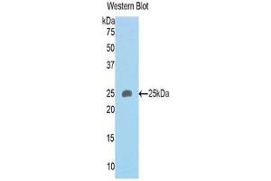 Western Blotting (WB) image for anti-Sema Domain, Immunoglobulin Domain (Ig), Transmembrane Domain (TM) and Short Cytoplasmic Domain, (Semaphorin) 4B (SEMA4B) (AA 31-240) antibody (ABIN1171802) (SEMA4B antibody  (AA 31-240))