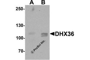 Western Blotting (WB) image for anti-DEAH (Asp-Glu-Ala-His) Box Polypeptide 36 (DHX36) (C-Term) antibody (ABIN1077418) (DHX36 antibody  (C-Term))
