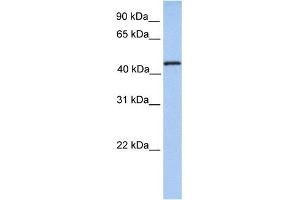 TRMT11 antibody used at 1 ug/ml to detect target protein. (Trmt11 antibody)