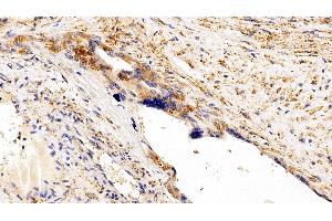 Immunohistochemistry (IHC) image for anti-Interleukin 6 Signal Transducer (Gp130, Oncostatin M Receptor) (IL6ST) (AA 392-566) antibody (ABIN7430552)