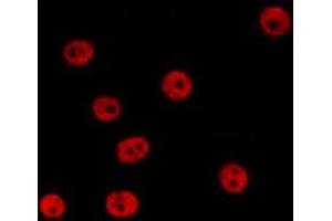 ABIN6267529 staining 293 by IF/ICC. (SAPK, JNK (pTyr185) antibody)
