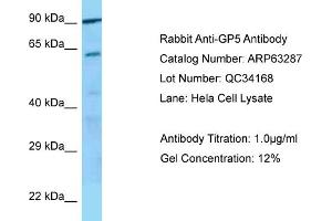 Western Blotting (WB) image for anti-Glycoprotein V (Platelet) (GP5) (C-Term) antibody (ABIN2789435) (GP5 antibody  (C-Term))