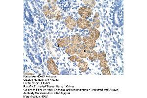 Rabbit Anti-DAZ4 Antibody  Paraffin Embedded Tissue: Human Kidney Cellular Data: Epithelial cells of renal tubule Antibody Concentration: 4. (DAZ4 antibody  (N-Term))