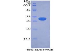 SDS-PAGE (SDS) image for PTEN Induced Putative Kinase 1 (PINK1) (AA 262-507) protein (His tag) (ABIN2126572)