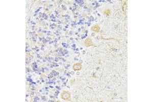 Immunohistochemistry of paraffin-embedded rat cerebellum using K/K/Elp3 antibody (ABIN6130883, ABIN6140142, ABIN6140143 and ABIN6225217) at dilution of 1:100 (40x lens). (ELP3/KAT9 antibody  (AA 358-547))