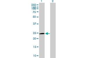 Western Blot analysis of TRIM50C expression in transfected 293T cell line by TRIM50C MaxPab polyclonal antibody.