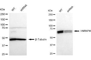 Western blotting analysis using HNRNPM antibody (ABIN7798901). (Recombinant HNRNPM antibody)