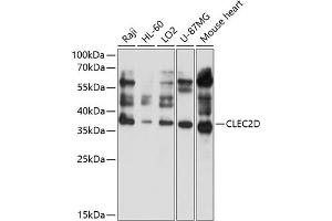 Western blot analysis of extracts of various cell lines, using CLEC2D antibody (ABIN6130113, ABIN6138707, ABIN6138708 and ABIN6214667) at 1:1000 dilution. (CLEC2D antibody  (AA 60-154))