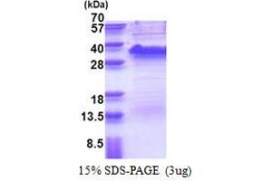 SDS-PAGE (SDS) image for Signal Sequence Receptor, alpha (SSR1) (AA 22-207) protein (His tag) (ABIN6387332) (SSR1 Protein (AA 22-207) (His tag))