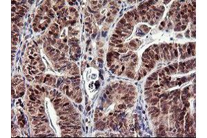 Image no. 2 for anti-Tumor Protein P73 (TP73) (AA 167-409) antibody (ABIN1491006) (Tumor Protein p73 antibody  (AA 167-409))