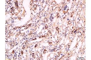 Formalin-fixed and paraffin embedded human kidney labeled with Anti- Pan FOXD Polyclonal Antibody, Unconjugated  at 1:200 followed by conjugation to the secondary antibody and DAB staining. (FOXD (AA 131-230) antibody)