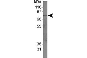 Western blot analysis of ACSL1 in HepG2 whole cell lysates using ACSL1 polyclonal antibody . (ACSL1 antibody  (AA 1-100))
