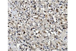 IHC analysis of OGT using anti-OGT antibody (ABIN3043893). (OGT antibody  (C-Term))
