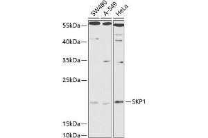 Western blot analysis of extracts of various cell lines, using SKP1 antibody (ABIN6130683, ABIN6147817, ABIN6147819 and ABIN6216158) at 1:1000 dilution. (SKP1 antibody  (AA 1-163))
