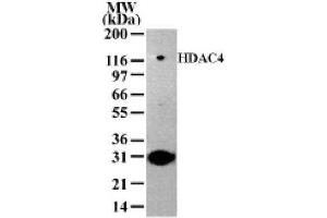 HDAC4 antibody (pAb) tested by Western blot. (HDAC4 antibody  (AA 194-209))