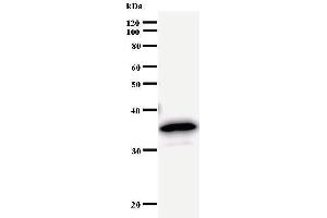 Western Blotting (WB) image for anti-Bromodomain Containing 3 (BRD3) antibody (ABIN933105) (BRD3 antibody)