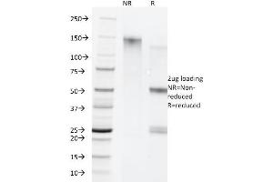SDS-PAGE Analysis Purified Cytokeratin 5/8 Monoclonal Antibody (C-50). (Keratin 5/8 antibody)