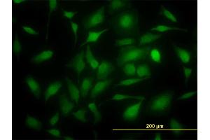 Immunofluorescence of monoclonal antibody to TYMS on HeLa cell. (TYMS antibody  (AA 111-210))