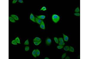Immunofluorescence staining of Hela cells with ABIN7151572 at 1:200, counter-stained with DAPI. (IKAP/p150 antibody  (AA 1107-1258))