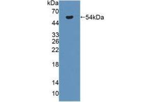 Figure. (SERPINC1 antibody  (AA 33-465))