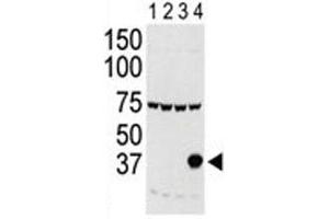 Western blot testing of Aurora-C antibody and lysate of 293 cells expressing 1) Flag tag, 2) Flag-tagged -A, 3) -B and 4) Aurora-C. (Aurora Kinase C antibody  (AA 1-30))