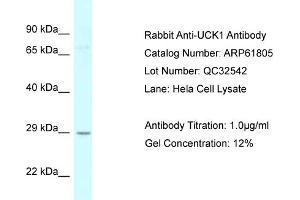 Western Blotting (WB) image for anti-Uridine-Cytidine Kinase 1 (UCK1) (N-Term) antibody (ABIN2788909) (UCK1 antibody  (N-Term))