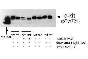 Image no. 1 for anti-Mast/stem Cell Growth Factor Receptor (KIT) (pTyr721) antibody (ABIN196992) (KIT antibody  (pTyr721))