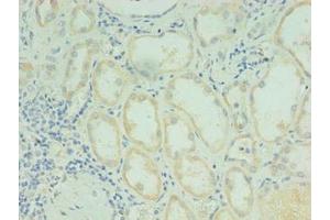 Immunohistochemistry of paraffin-embedded human kidney tissue using ABIN7167836 at dilution of 1:100 (RDH12 antibody  (AA 1-316))