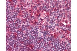 Anti-SYK antibody IHC of human tonsil.