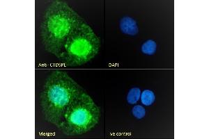 (ABIN263205) Immunofluorescence analysis of paraformaldehyde fixed A431 cells, permeabilized with 0. (CTDSPL antibody  (Internal Region))