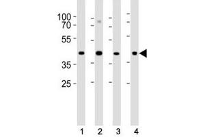 Western blot analysis of lysate from (1) HeLa, (2) U-87 MG, (3) rat C6 cell line and (4) mouse heart tissue lysate using Connexin 43 antibody at 1:1000. (Connexin 43/GJA1 antibody  (AA 107-138))