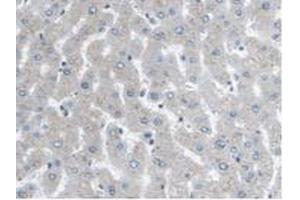 IHC-P analysis of Human Liver Tissue, with DAB staining. (ARPC4 antibody  (AA 3-165))